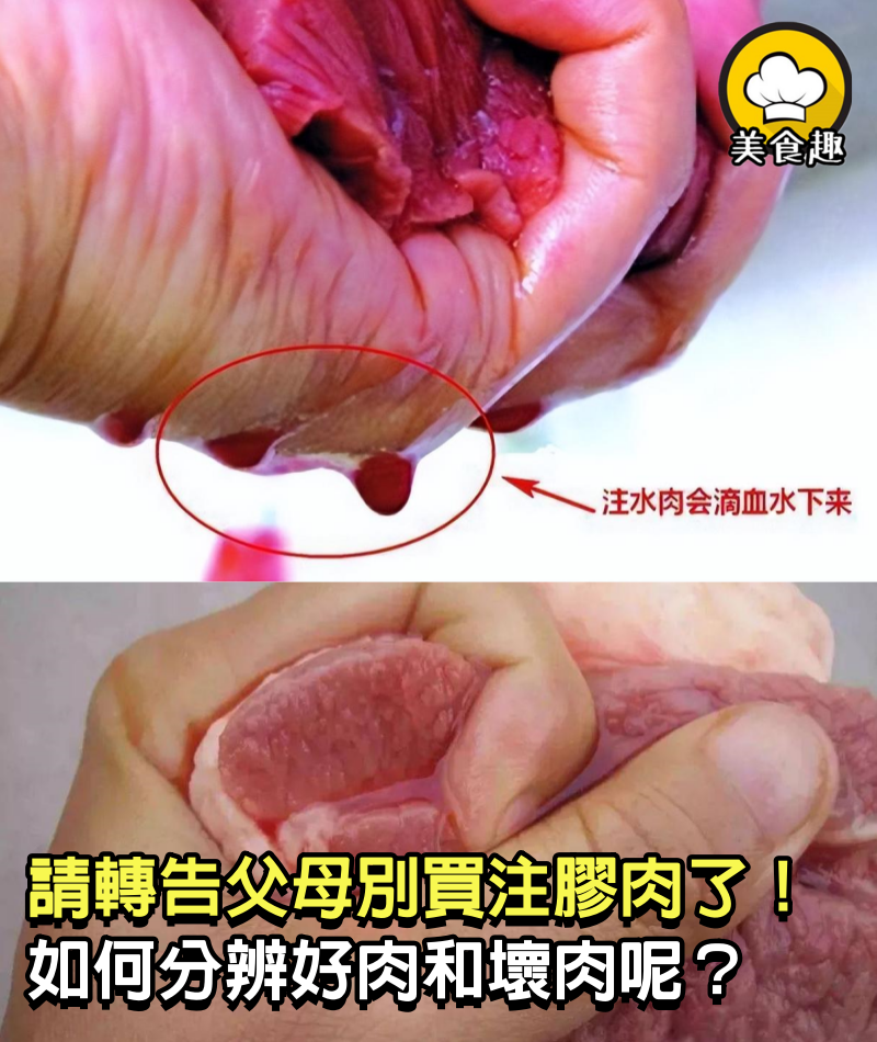 「注膠肉」已氾濫？這幾種肉謀財又害命，請轉告父母要管住嘴