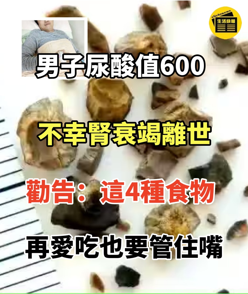 男子尿酸值600,不幸腎衰竭離世,勸告:這4種食物再愛吃也要管住嘴.